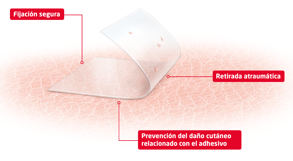 Imagen de producto que muestra los beneficios de la tecnología skin sensitive: fijación segura, retirada atraumática y prevención de lesiones cutáneas relacionadas con el adhesivo.  Imagen de producto que muestra los beneficios de la tecnología skin sensitive: fijación segura, retirada atraumática y prevención de lesiones cutáneas relacionadas con el adhesivo.